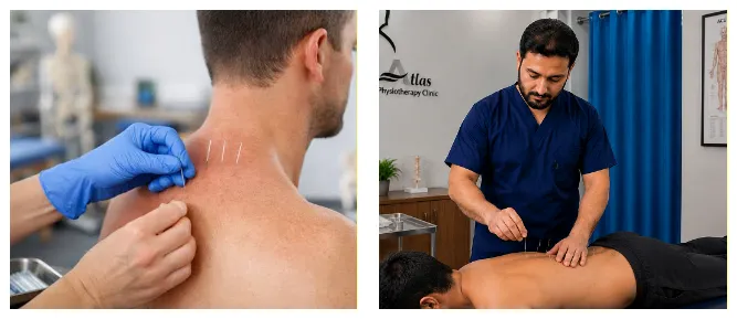 درای نیدلینگ در ارومیه در کلینیک اطلس